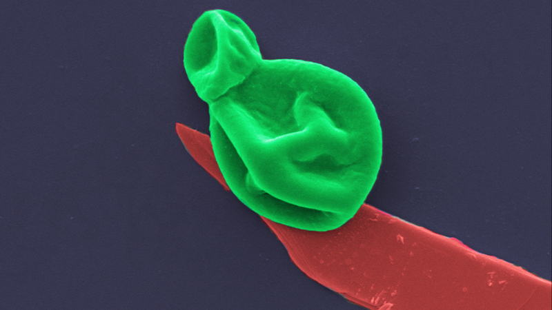 A fungal cell (green) interacting with a nanothin layer of black phosphorous (red). Image magnified 25,000 times (Credit: RMIT University)