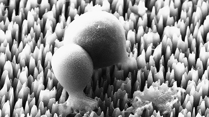 Golden staph bacteria being ruptured and destroyed by black silicon nanoneedles, an anti-bacterial surface inspired by insect wings. Image magnified 30,000-times (Credit: RMIT University)