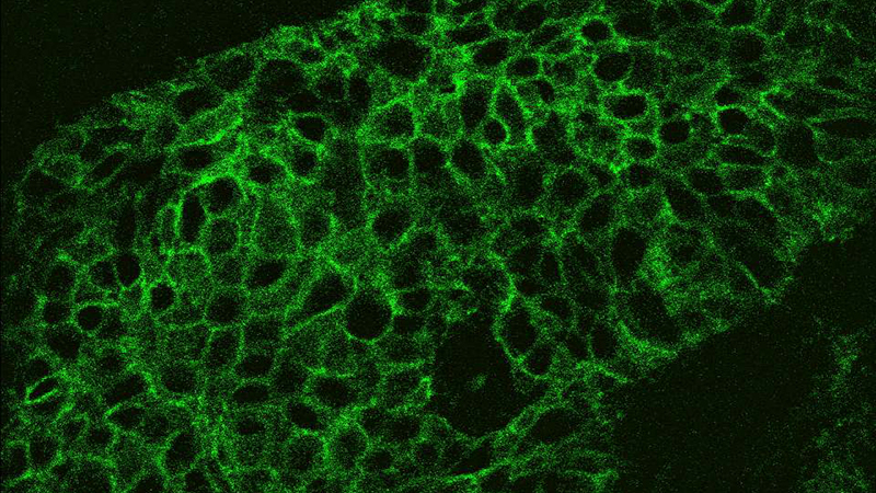 A tumour section recorded with the LSC-Onco microscope, showing cancer cells in fluorescent green (Credit: Fraunhofer)