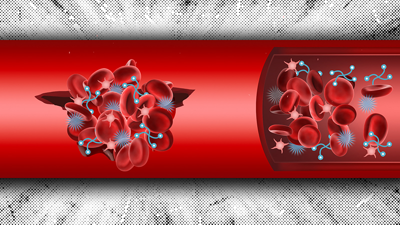 MIT engineers designed synthetic nanoparticles that can be injected into the body and help form blood clots at the sites of internal injury (Credits: Christine Daniloff/ MIT)