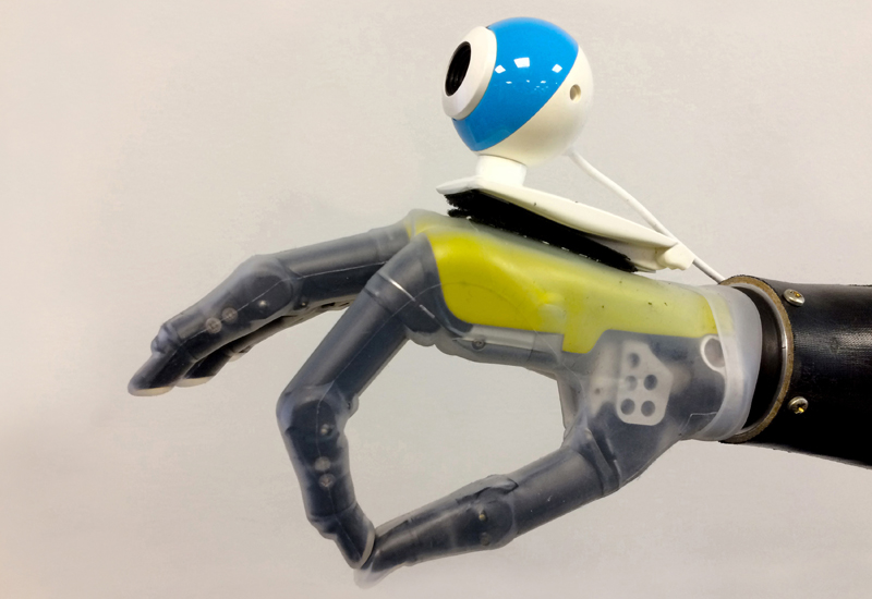 Bionic hand guided by 99p camera