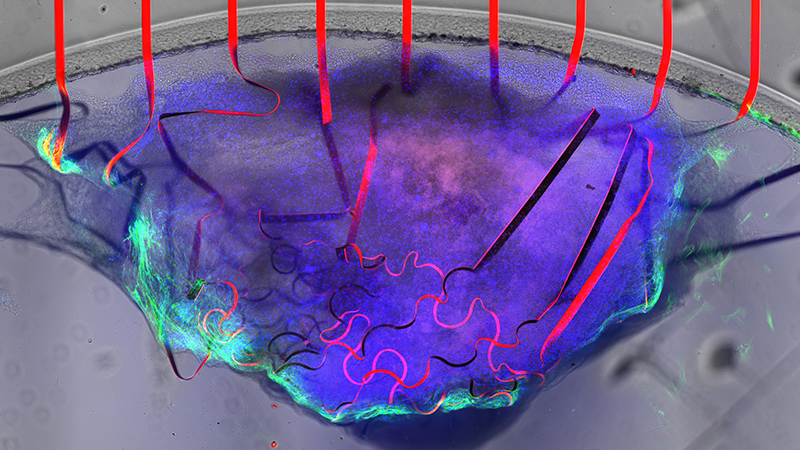 A bioelectronic mesh studded with graphene sensors (red) can measure the electrical signal and movement of cardiac tissue (purple and green) at the same time
