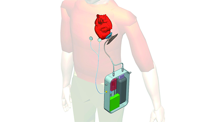 A concept image of the heart pump in action