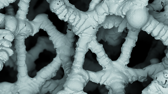 Osstec is developing knee replacement implants from additively manufactured titanium lattices