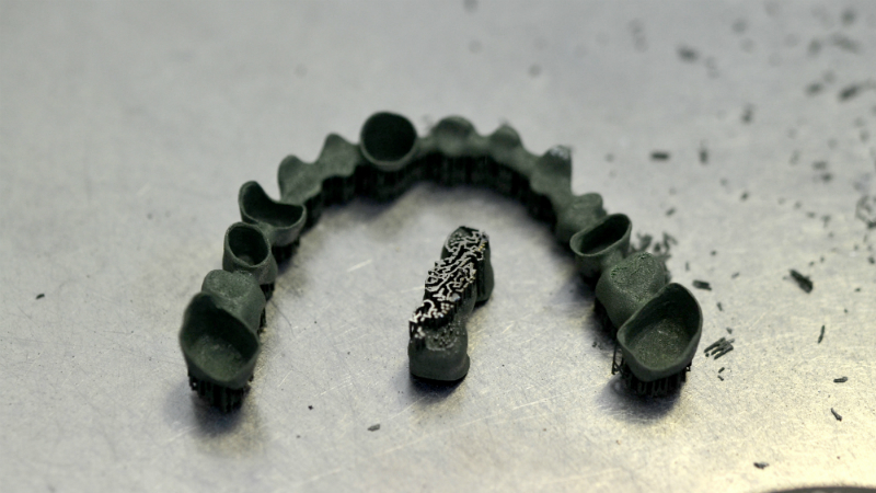Dental crowns can be made using additive manufacturing (Credit: Shutterstock)