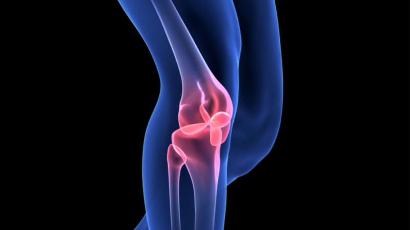 The artificial cartilage could be an alternative for patients considering knee replacement surgery (Credit: Shutterstock)
